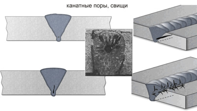Канальные поры, свищи